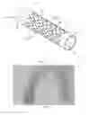 Fig. 02 - Flexible stretch stent-graft