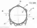 Fig. 04 - Flexible stretch stent-graft
