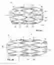Fig. 06 - Flexible stretch stent-graft