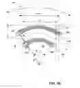 Fig. 08 - Flexible stretch stent-graft