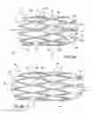 Fig. 11 - Flexible stretch stent-graft