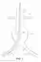 Fig. 02 - Bifurcated endovascular prosthesis having tethered contralateral leg