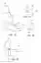 Fig. 11 - Bifurcated endovascular prosthesis having tethered contralateral leg