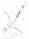 Fig. 12 - Transosseous suture anchor method