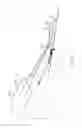 Fig. 17 - Transosseous suture anchor method