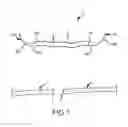 Fig. 02 - DEVICES AND METHODS FOR TENDON REPAIR