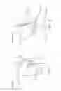 Fig. 02 - Internal brace for tissue repairs and reinforcements