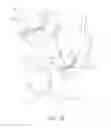 Fig. 11 - Internal brace for tissue repairs and reinforcements