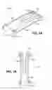 Fig. 02 - Scleral prosthesis for treating presbyopia and other eye disorders and related devices and methods