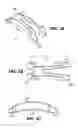Fig. 04 - Scleral prosthesis for treating presbyopia and other eye disorders and related devices and methods