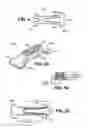 Fig. 06 - Scleral prosthesis for treating presbyopia and other eye disorders and related devices and methods