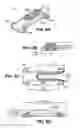 Fig. 08 - Scleral prosthesis for treating presbyopia and other eye disorders and related devices and methods