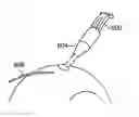 Fig. 01 - Scleral prosthesis for treating presbyopia and other eye disorders and related devices and methods