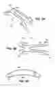 Fig. 04 - Scleral prosthesis for treating presbyopia and other eye disorders and related devices and methods