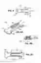 Fig. 06 - Scleral prosthesis for treating presbyopia and other eye disorders and related devices and methods