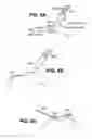 Fig. 12 - Scleral prosthesis for treating presbyopia and other eye disorders and related devices and methods
