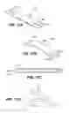Fig. 16 - Scleral prosthesis for treating presbyopia and other eye disorders and related devices and methods