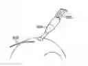 Fig. 01 - Scleral prosthesis for treating presbyopia and other eye disorders and related devices and methods