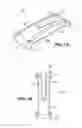 Fig. 02 - Scleral prosthesis for treating presbyopia and other eye disorders and related devices and methods
