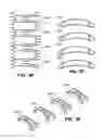Fig. 05 - Scleral prosthesis for treating presbyopia and other eye disorders and related devices and methods