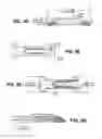 Fig. 07 - Scleral prosthesis for treating presbyopia and other eye disorders and related devices and methods