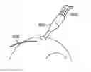 Fig. 01 - Scleral prosthesis for treating presbyopia and other eye disorders and related devices and methods