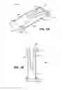 Fig. 02 - Scleral prosthesis for treating presbyopia and other eye disorders and related devices and methods