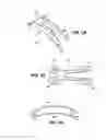 Fig. 04 - Scleral prosthesis for treating presbyopia and other eye disorders and related devices and methods
