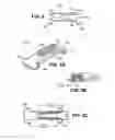 Fig. 06 - Scleral prosthesis for treating presbyopia and other eye disorders and related devices and methods