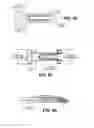 Fig. 09 - Scleral prosthesis for treating presbyopia and other eye disorders and related devices and methods