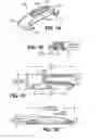 Fig. 10 - Scleral prosthesis for treating presbyopia and other eye disorders and related devices and methods