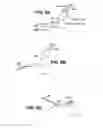 Fig. 12 - Scleral prosthesis for treating presbyopia and other eye disorders and related devices and methods
