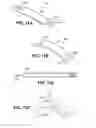 Fig. 16 - Scleral prosthesis for treating presbyopia and other eye disorders and related devices and methods