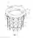 Fig. 02 - Vascular implant and delivery system