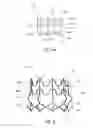 Fig. 05 - Vascular implant and delivery system