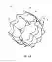 Fig. 06 - Vascular implant and delivery system