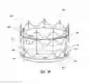 Fig. 33 - Vascular implant and delivery system