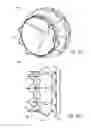 Fig. 45 - Vascular implant and delivery system