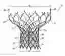 Fig. 01 - Heart valve prosthesis and methods of manufacture and use