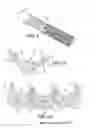 Fig. 03 - Heart valve prosthesis and methods of manufacture and use