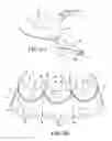 Fig. 04 - Heart valve prosthesis and methods of manufacture and use
