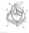Fig. 01 - REPLACEMENT PROSTHETIC HEART VALVES AND METHODS OF IMPLANTATION