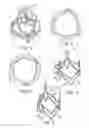 Fig. 02 - REPLACEMENT PROSTHETIC HEART VALVES AND METHODS OF IMPLANTATION
