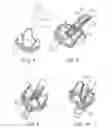 Fig. 04 - REPLACEMENT PROSTHETIC HEART VALVES AND METHODS OF IMPLANTATION