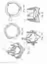 Fig. 05 - REPLACEMENT PROSTHETIC HEART VALVES AND METHODS OF IMPLANTATION