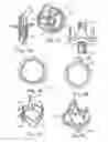 Fig. 06 - REPLACEMENT PROSTHETIC HEART VALVES AND METHODS OF IMPLANTATION
