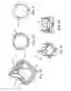 Fig. 08 - REPLACEMENT PROSTHETIC HEART VALVES AND METHODS OF IMPLANTATION