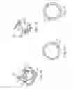 Fig. 11 - REPLACEMENT PROSTHETIC HEART VALVES AND METHODS OF IMPLANTATION