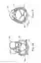 Fig. 13 - REPLACEMENT PROSTHETIC HEART VALVES AND METHODS OF IMPLANTATION