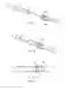 Fig. 06 - Stent valve, delivery apparatus and method therefor